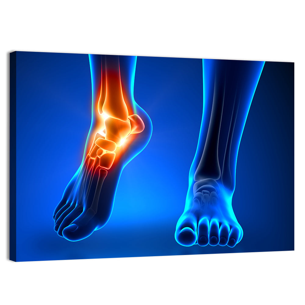 Ankle Pain Anatomy Wall Art
