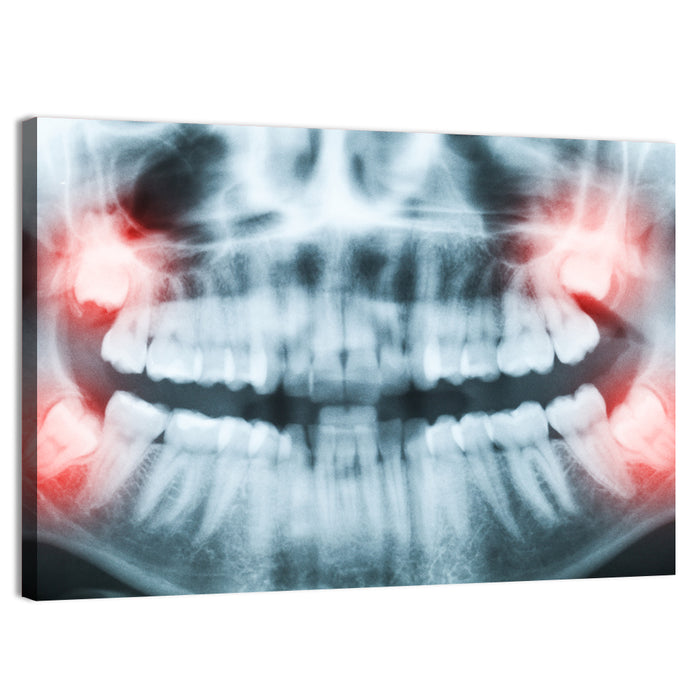 Dental X-ray Radiograph Wall Art as a canvas print