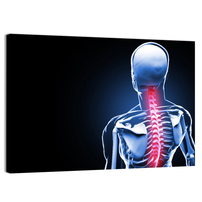 Spine Pain Anatomy Illustration Wall Art as a canvas print
