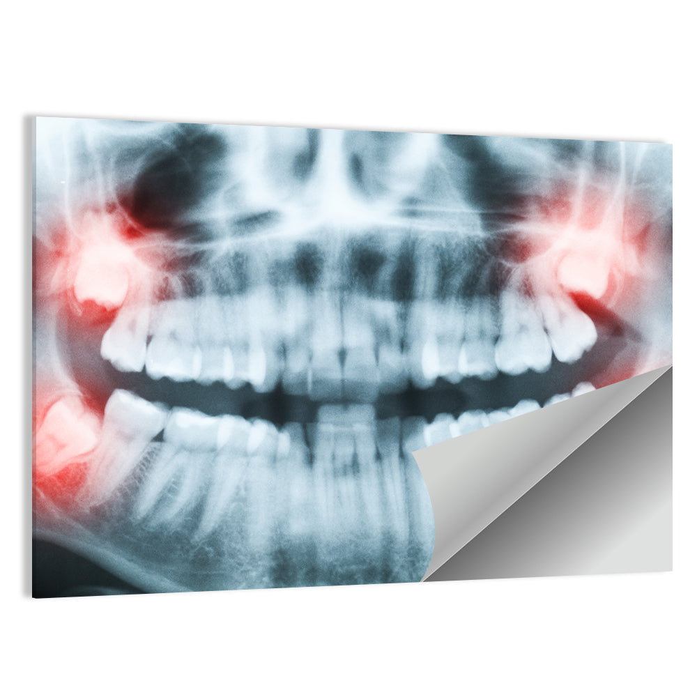 X-Ray Of Teeth & Mouth Wall Art