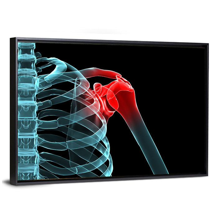 Lateral Shoulder X-ray Wall Art as a framed canvas
