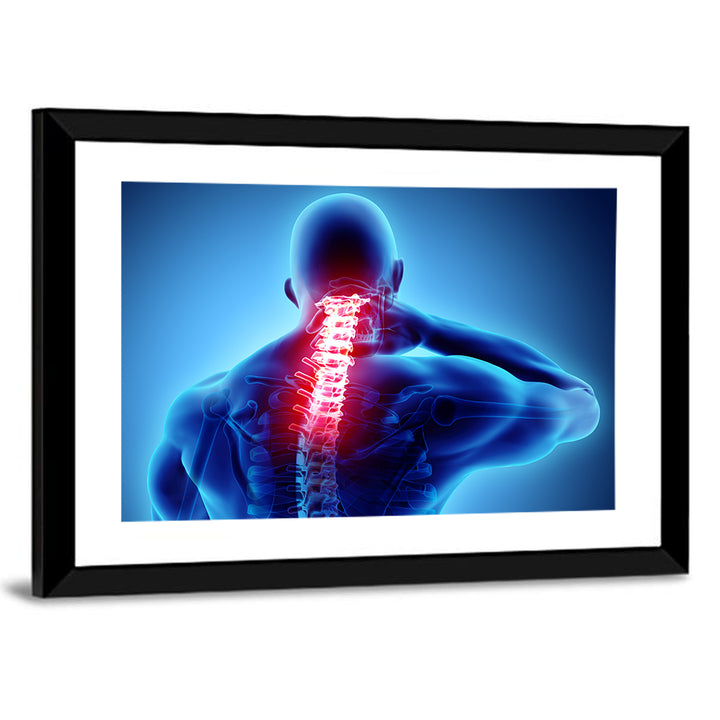 Cervical Spine X-ray Illustration Wall Art