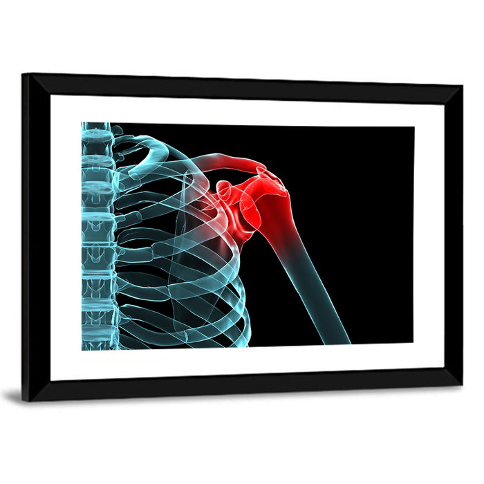 Lateral Shoulder X-ray Wall Art as a framed print
