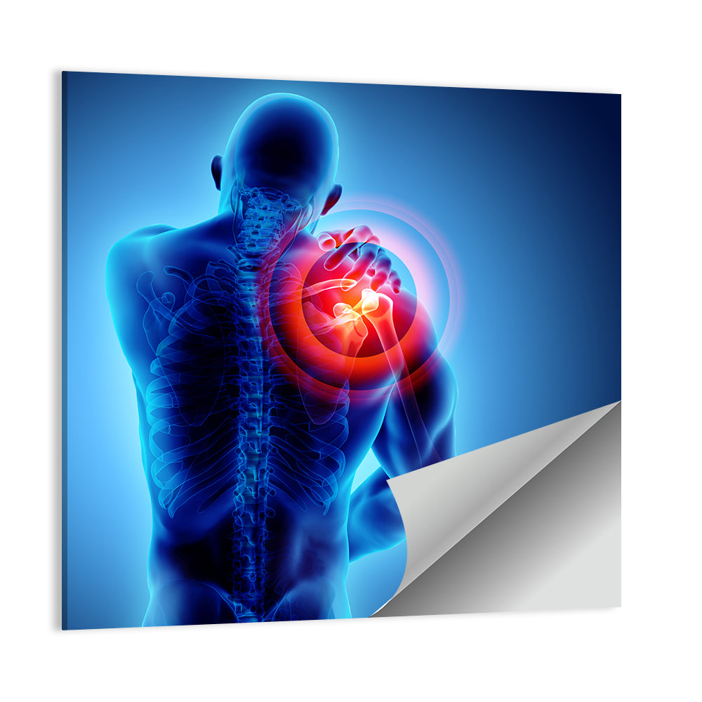 Shoulder Painful X-Ray Wall Art