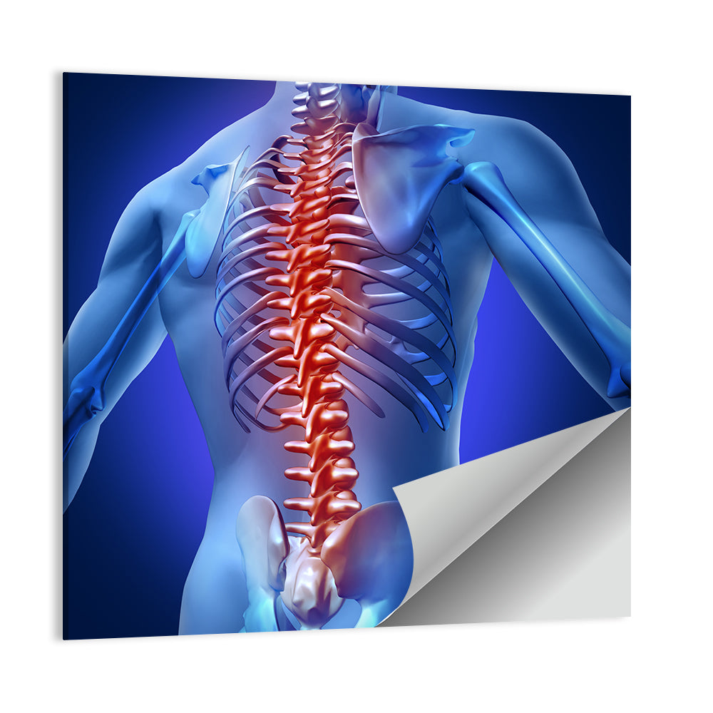 Human Backache Pain Wall Art