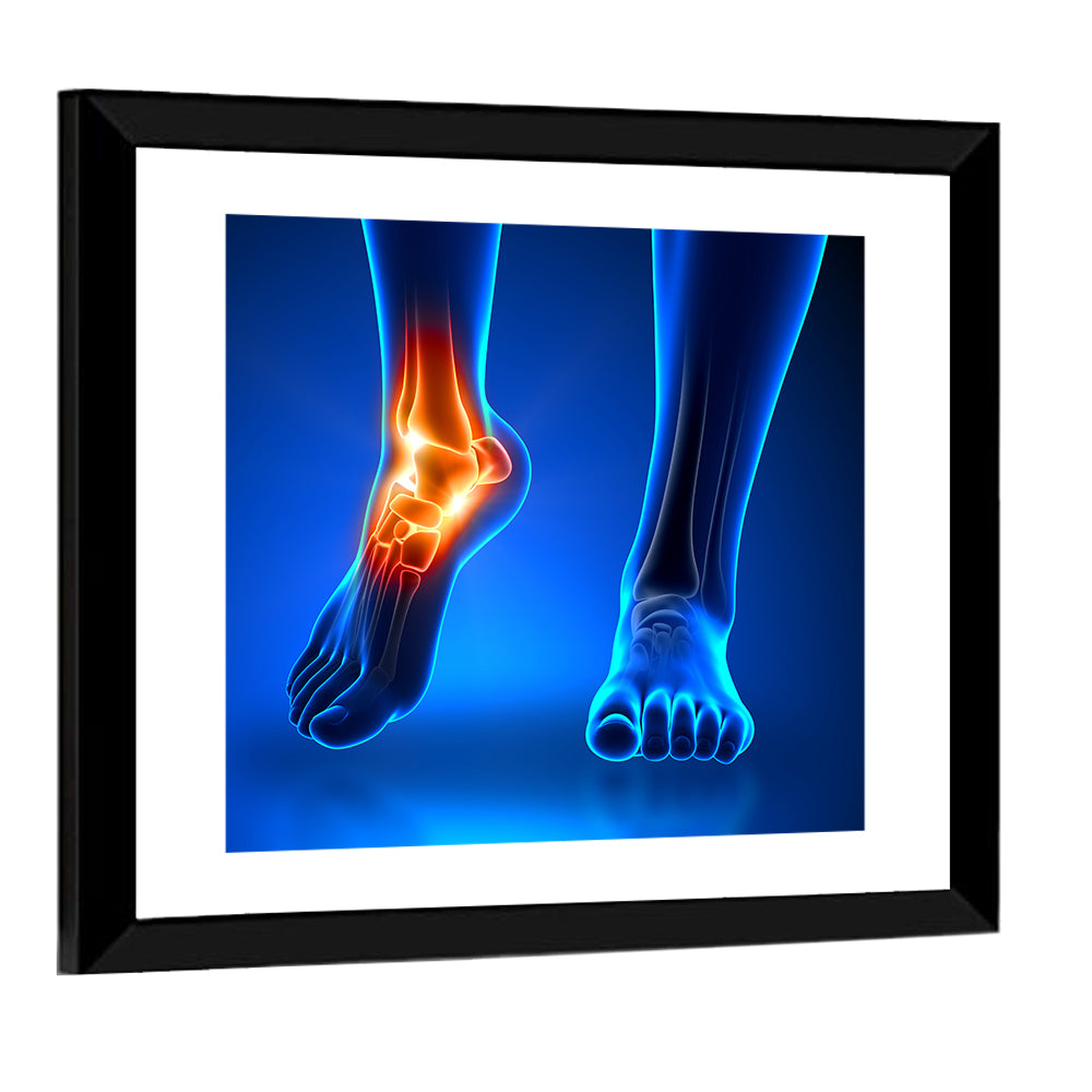 Ankle Pain Anatomy Wall Art