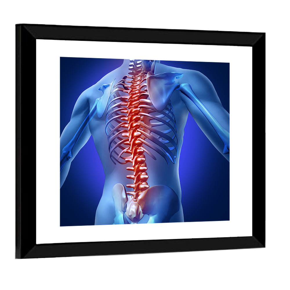 Human Backache Pain Wall Art
