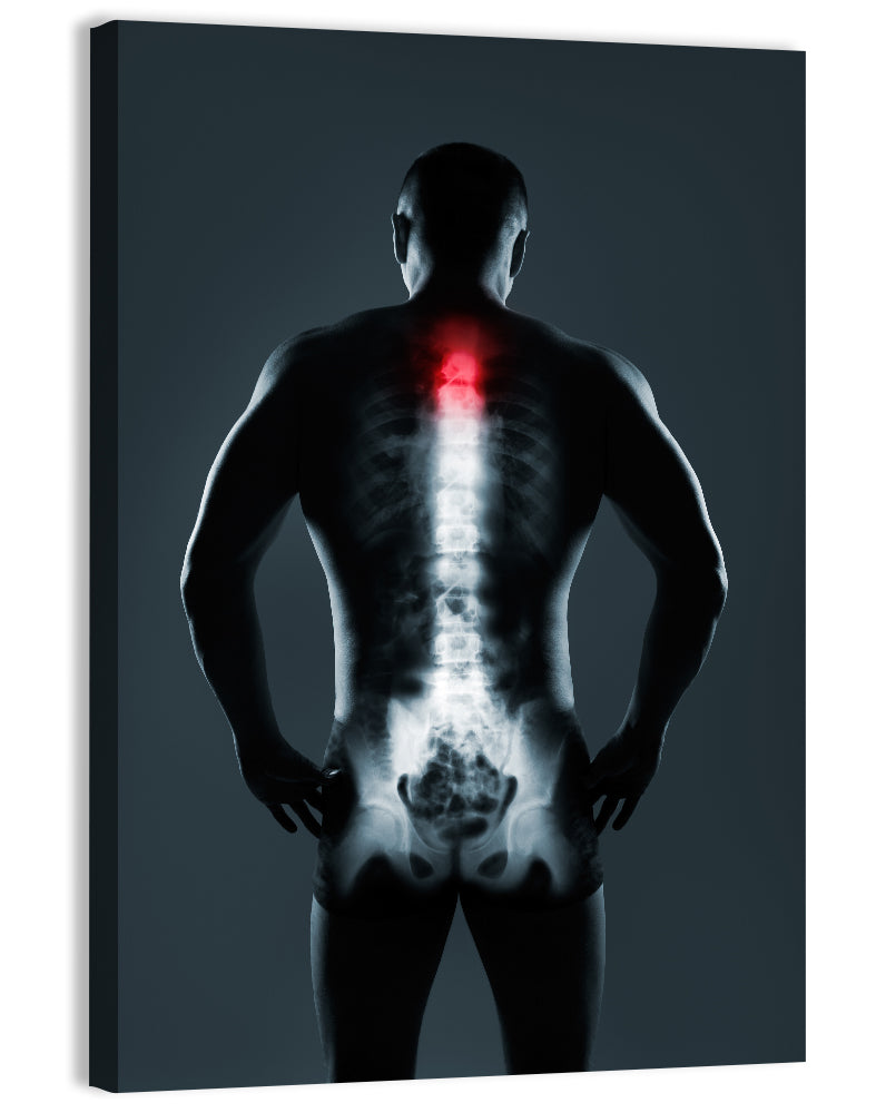 Human Spine X-ray Wall Art, canvas print, portrait