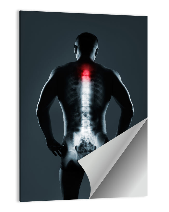 Human Spine X-ray Wall Art as a poster print