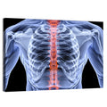 Male Spine X-ray Illustration Wall Art