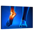 Ankle Pain Anatomy Wall Art