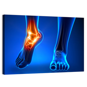 Ankle Pain Anatomy Wall Art