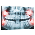 Dental X-ray Radiograph Wall Art