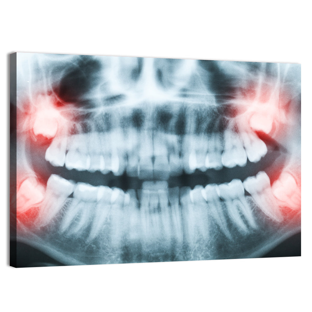Dental X-ray Radiograph Wall Art
