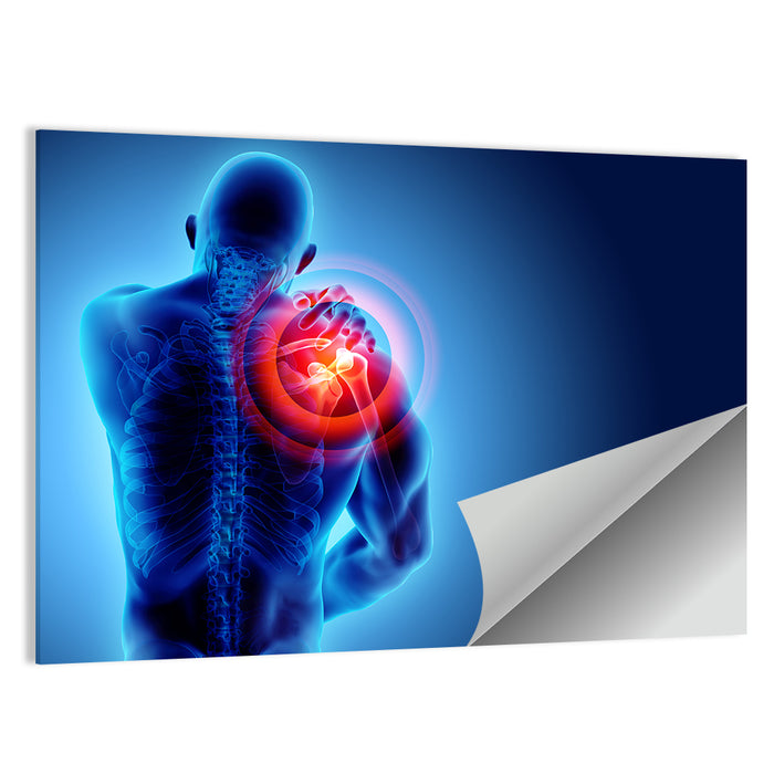 Shoulder Pain X-ray Wall Art as a poster print
