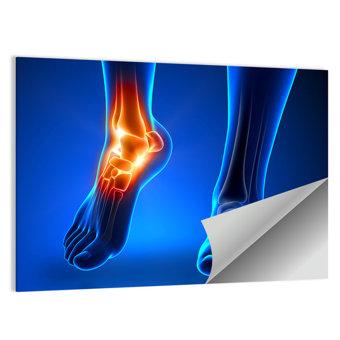 Ankle Pain Anatomy Wall Art as a poster print