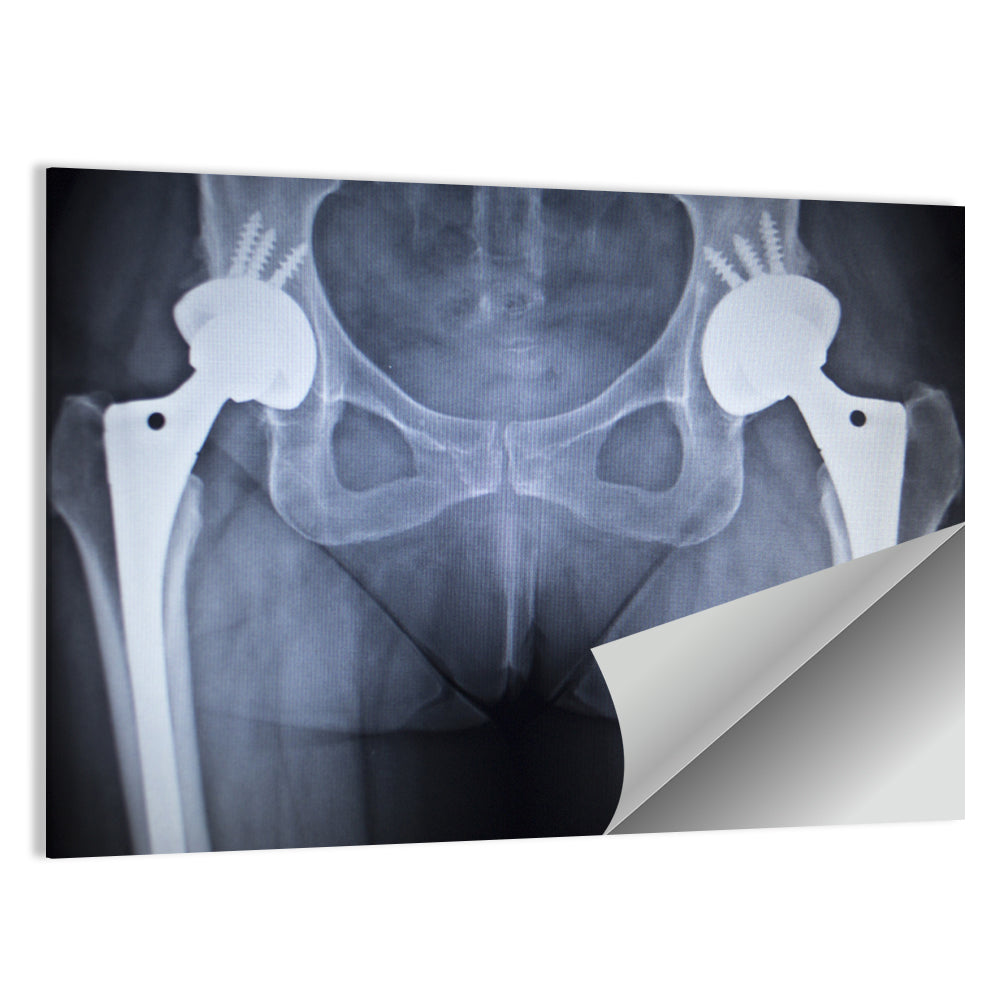 X-Ray Of Hip Joints Wall Art