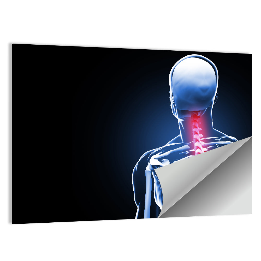 Spine Pain Anatomy Illustration Wall Art