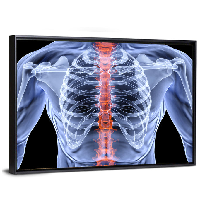 Male Spine X-ray Illustration Wall Art as a framed canvas