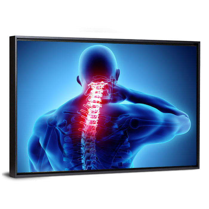 Cervical Spine X-ray Illustration Wall Art as a framed canvas