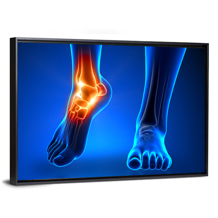 Ankle Pain Anatomy Wall Art as a framed canvas