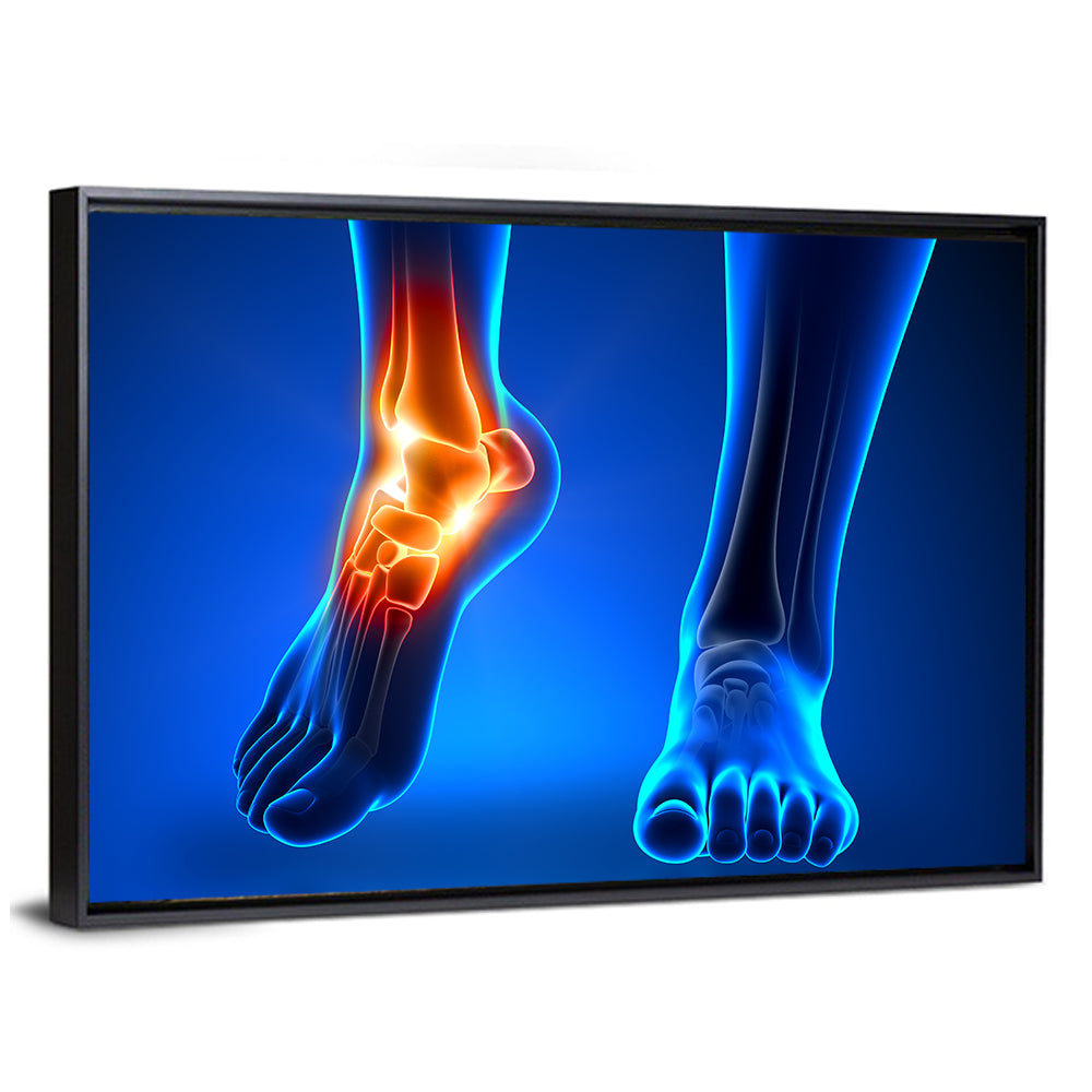 Ankle Anatomy X-ray Study Wall Art