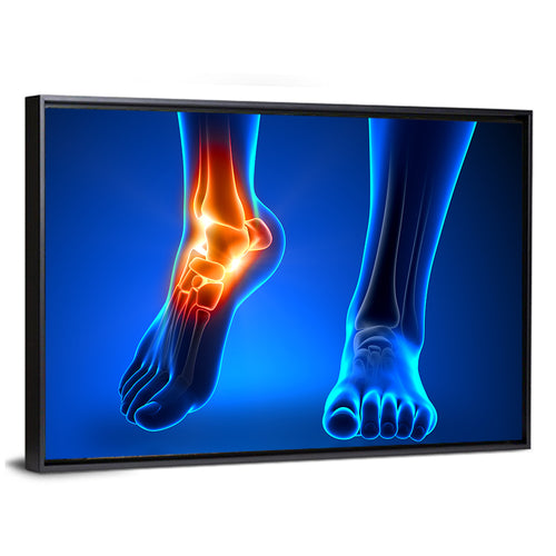 Ankle Anatomy X-ray Study Wall Art