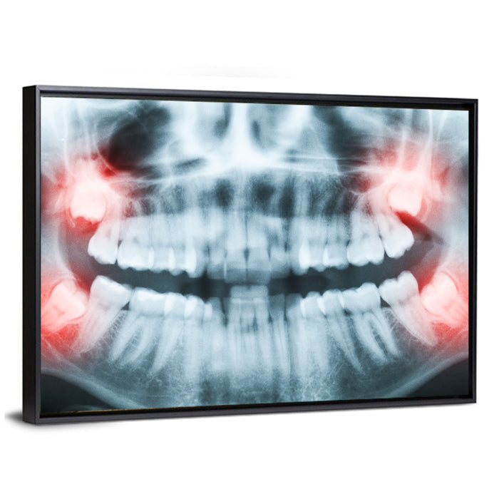 Dental X-ray Radiograph Wall Art as a framed canvas