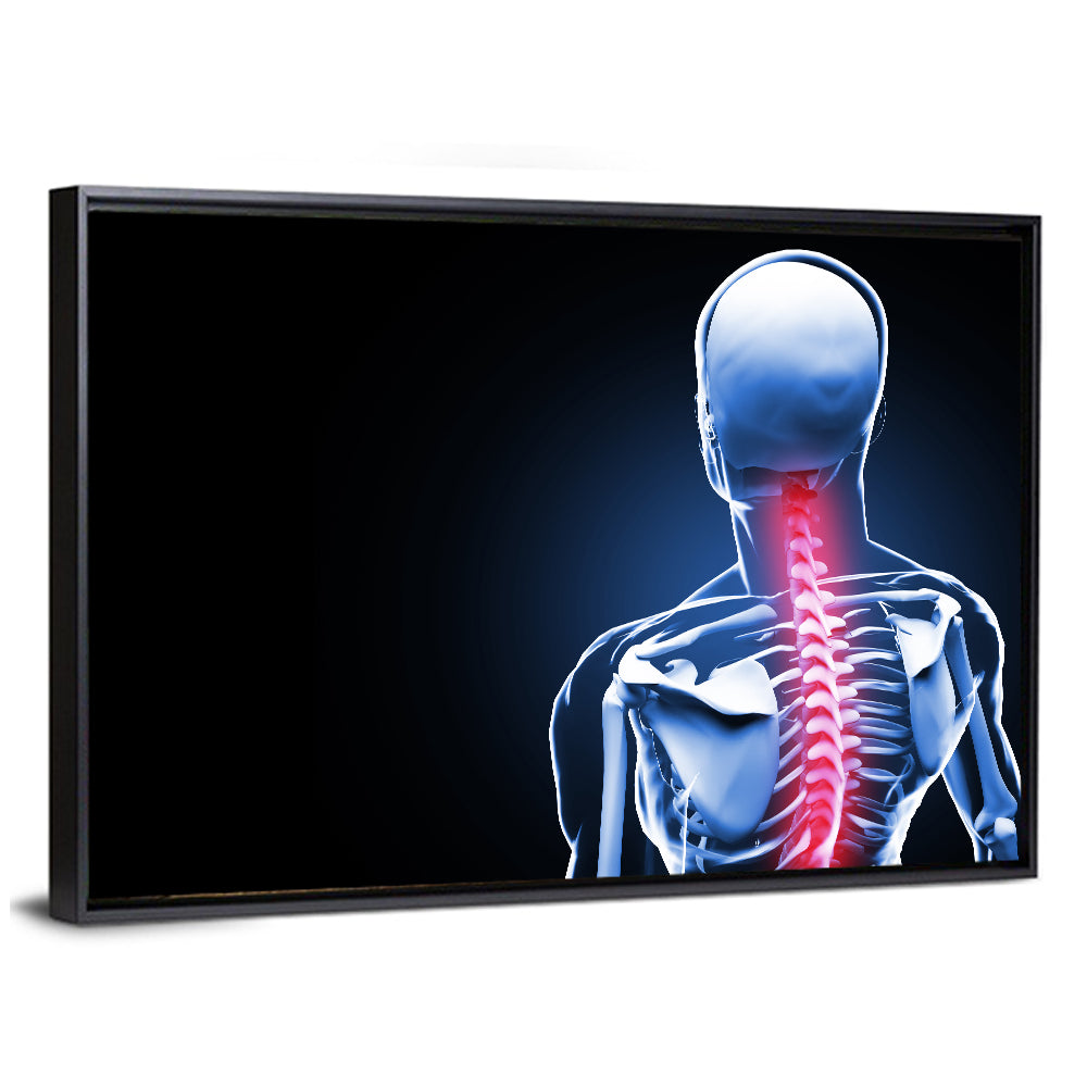 Spine Pain Anatomy Illustration Wall Art