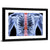 Men Backbone X-Ray Wall Art