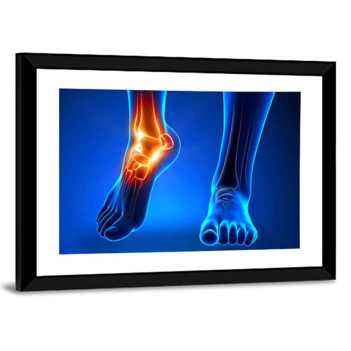Ankle Pain Anatomy Wall Art as a framed print