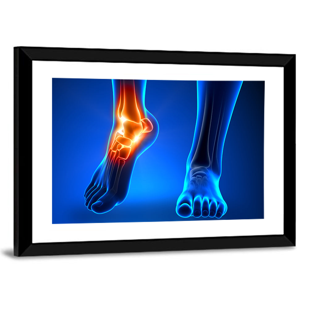 Ankle Anatomy X-ray Study Wall Art