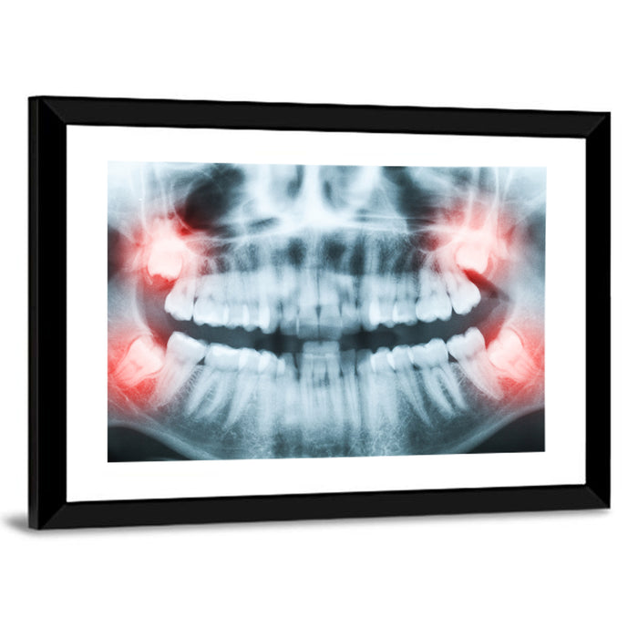 Dental X-ray Radiograph Wall Art as a framed print