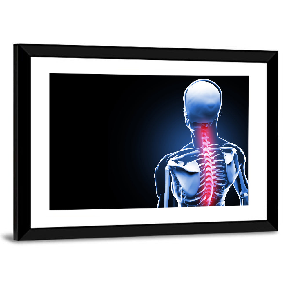 Spine Pain Anatomy Illustration Wall Art