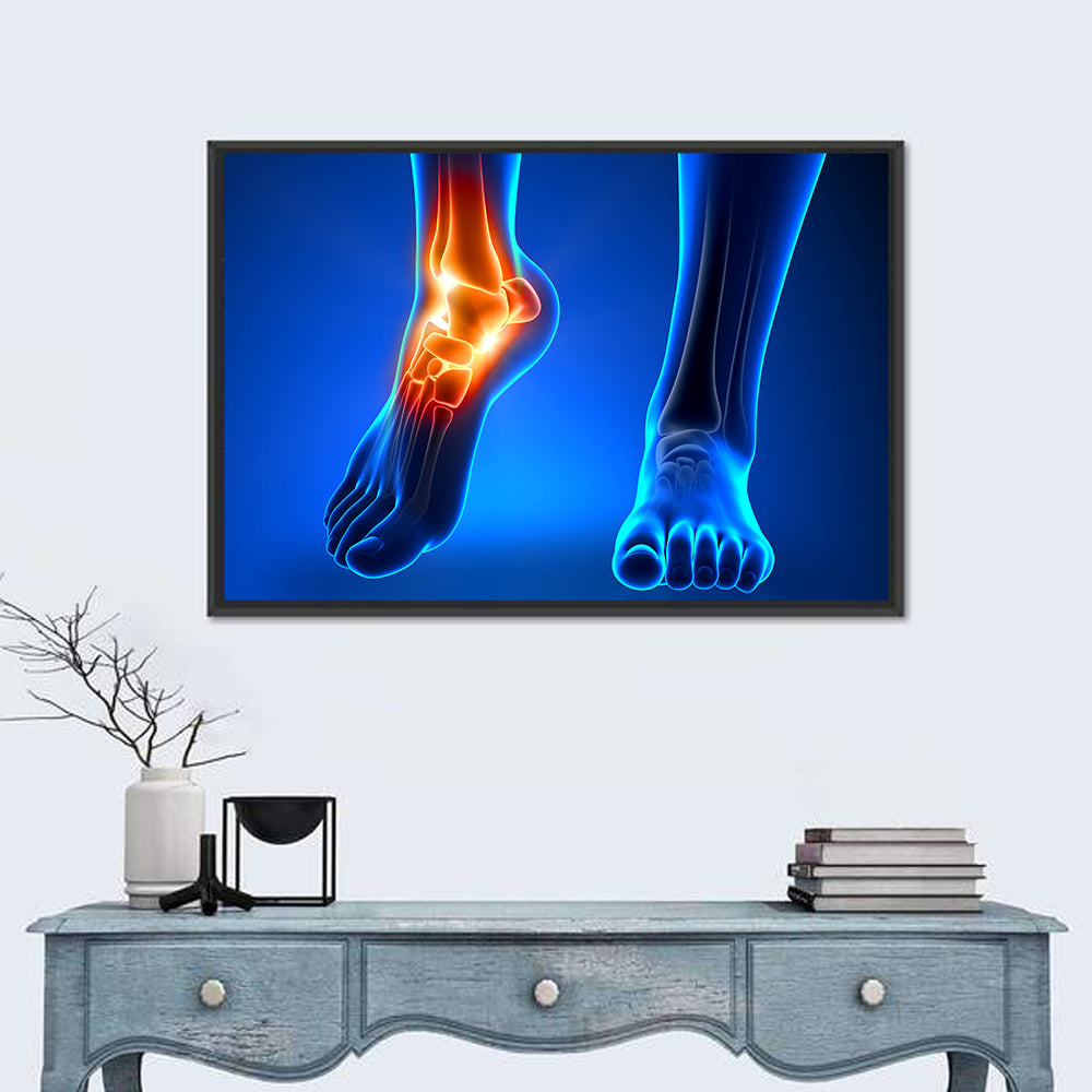 Ankle Pain Anatomy Wall Art in a room, landscape
