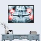 Dental X-ray Radiograph Wall Art