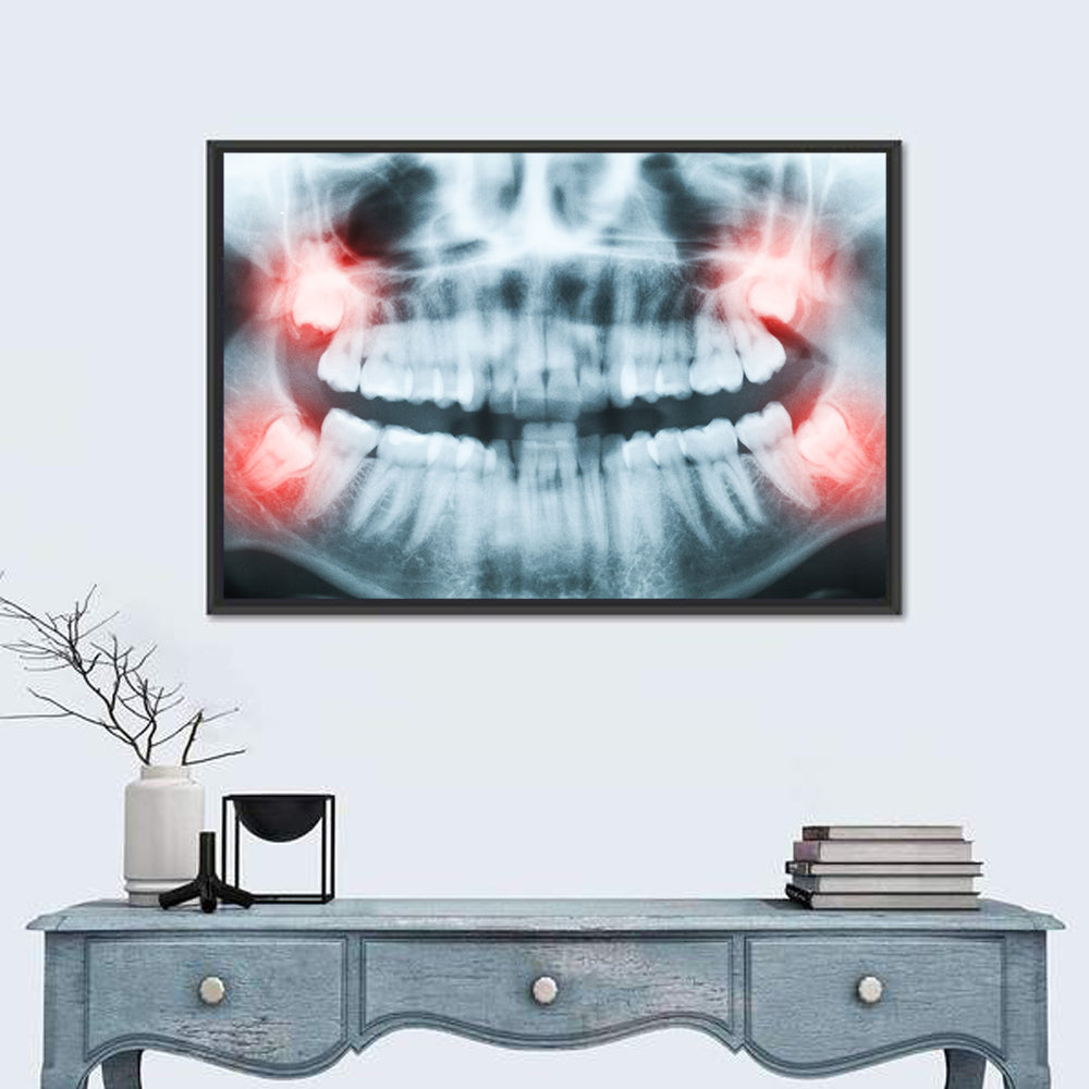 X-Ray Of Teeth & Mouth  Wall Art