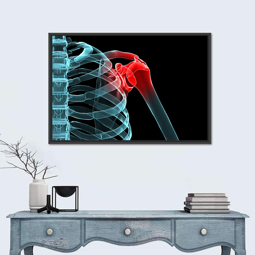 Lateral Shoulder X-ray Wall Art in a room, landscape