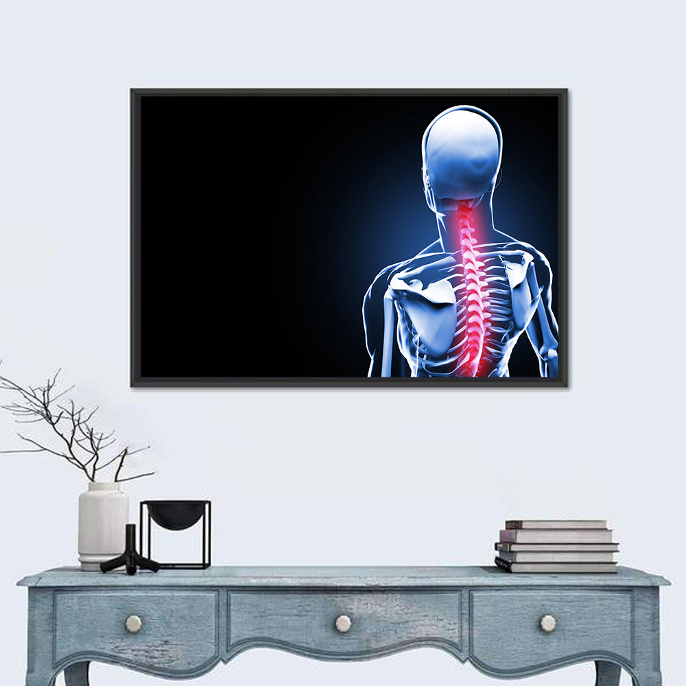 Spine Pain Anatomy Illustration Wall Art in a room, landscape