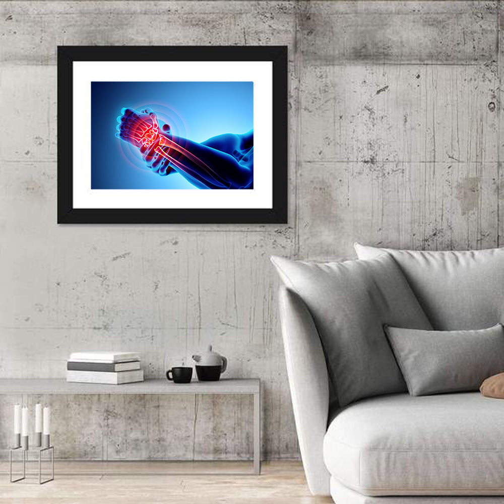 Painful Wrist X-ray Illustration Wall Art in a room, landscape