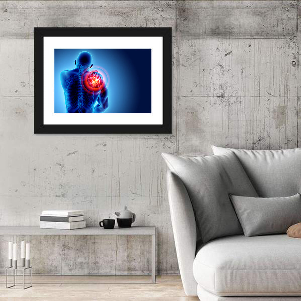 Shoulder Pain X-ray Wall Art