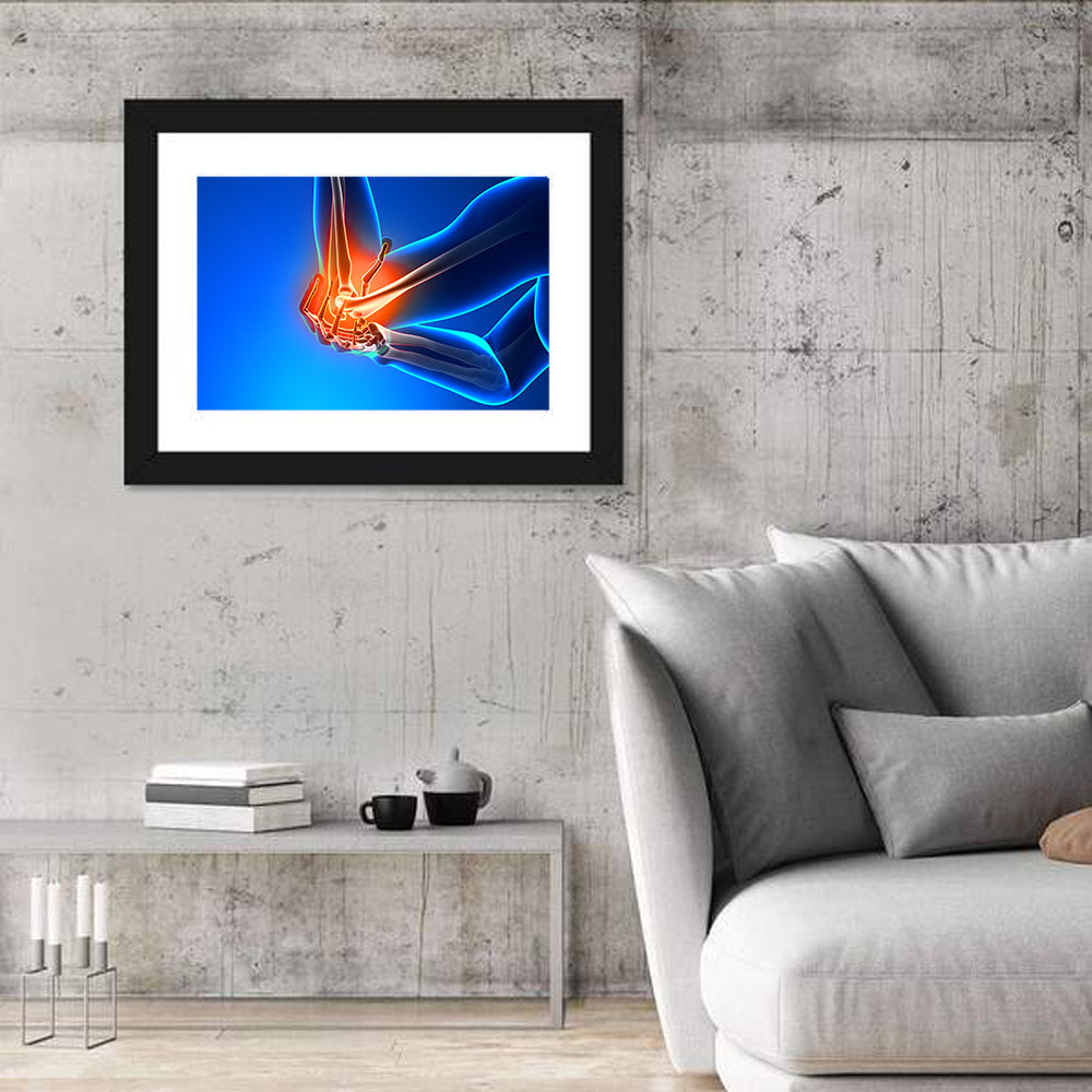 Elbow Joint Inflammation Illustration Wall Art in a room, landscape