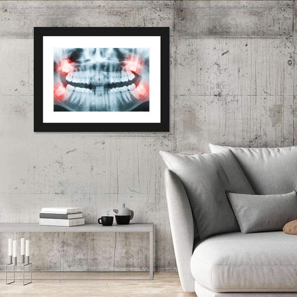 Dental X-ray Radiograph Wall Art in a room, landscape