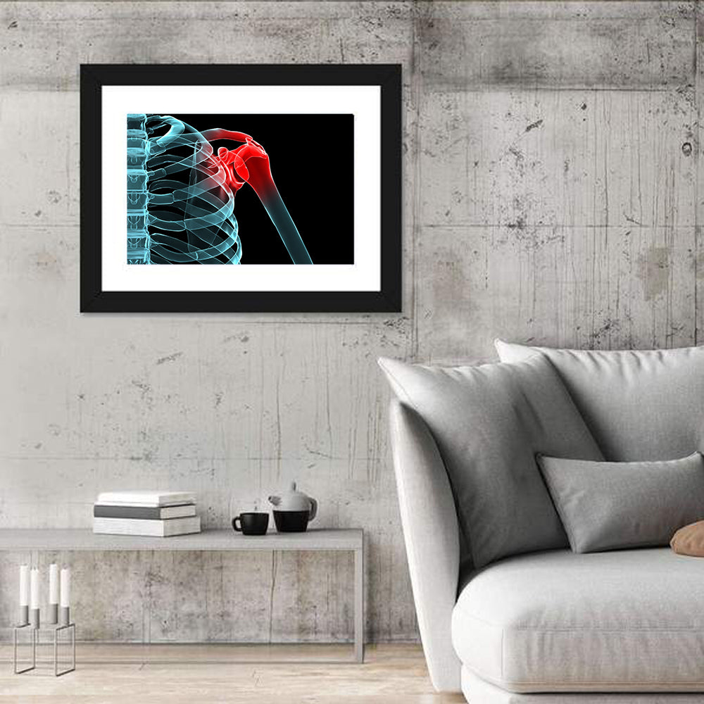 Lateral Shoulder X-ray Wall Art