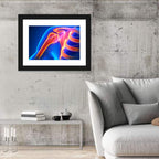Shoulder Pain Anatomy Study Wall Art