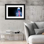 Spine Pain Anatomy Illustration Wall Art