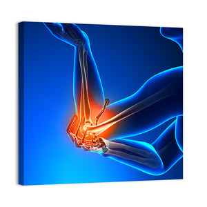 Elbow Pain Wall Art