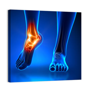 Ankle Pain Wall Art