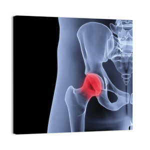 Male Pelvis Under The X-Rays Wall Art