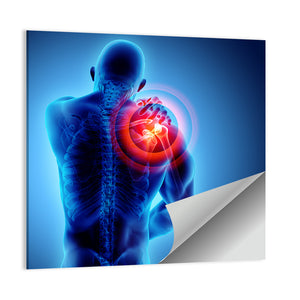 Shoulder Painful X-Ray Wall Art